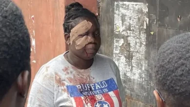 Photo of 2023 Polls: Lagosian attacked by hoodlums returns to vote with bloodied face