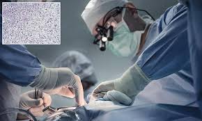 Photo of Doctor catches cancer from patient in first-of-a-kind case 