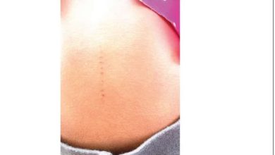 Photo of Parents tackle school over strange bodily incisions on pupils bodies 