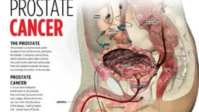 Photo of Prostate Cancer: 5 early symptoms men shouldn’t ignore