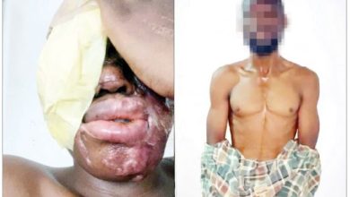 Photo of I was paid N500,000 to bathe female spa worker with acid, Suspect confesses